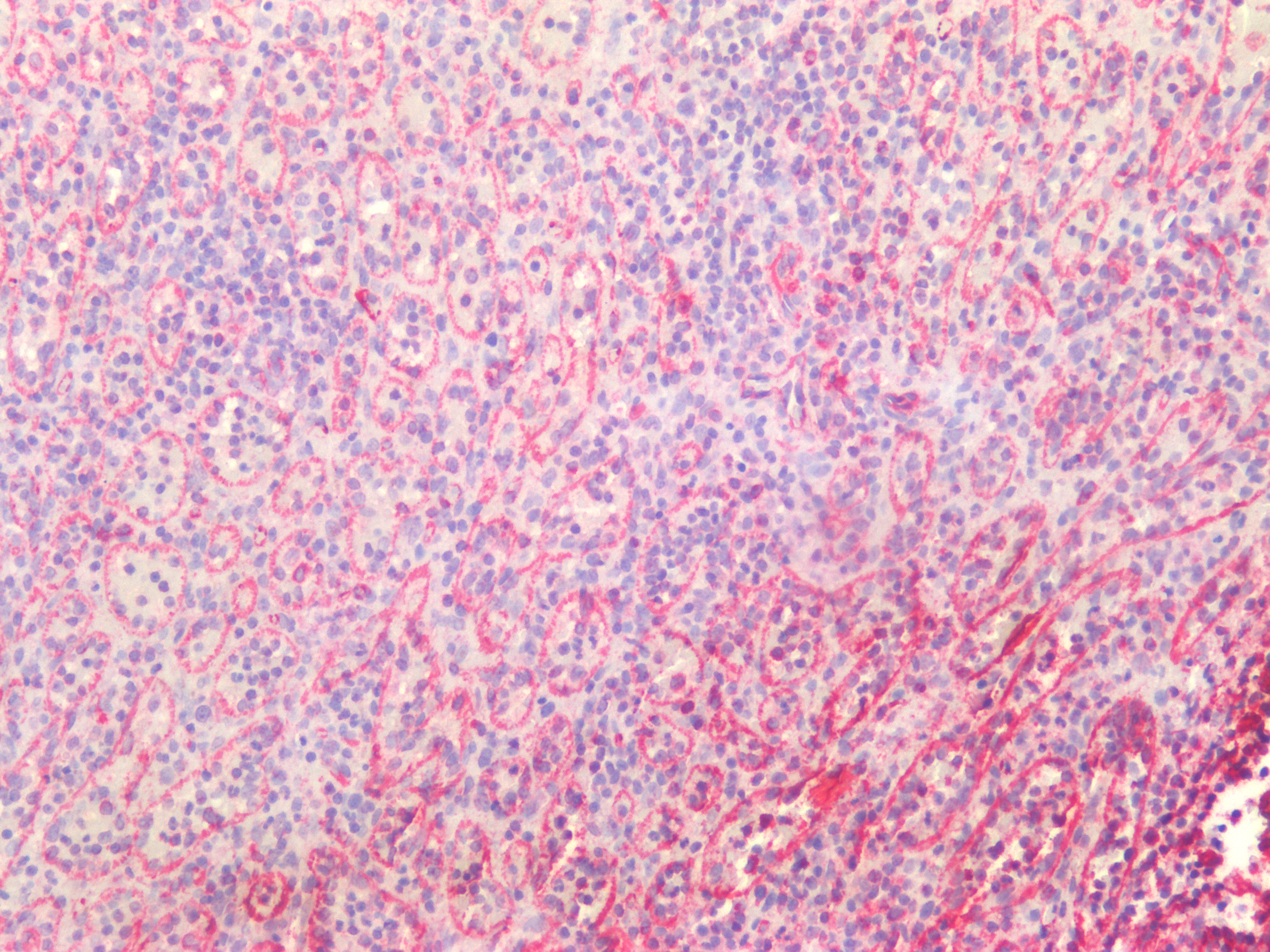 Figure 9. Immunostaining of human paraffin embedded tissue sections of human spleen with MUB1903P (diluted 1:100), showing the specific pattern of vimentin in the mesenchymal cell types.